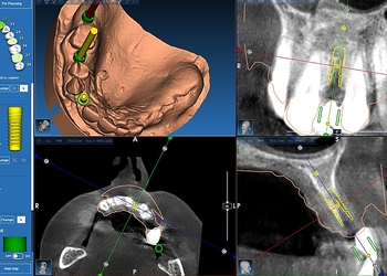 Фото клиники Центр дентальной имплантологии Атлант — №3