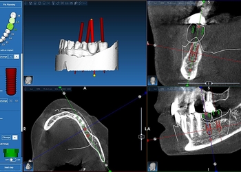Фото клиники Центр дентальной имплантологии Атлант — №8