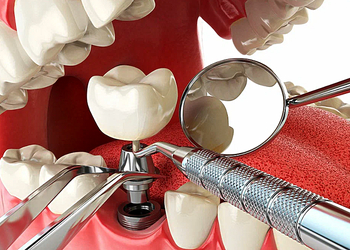 Фото клиники Цифровая стоматология на Московской — №39