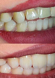 Фото клиники Клиника Эффективной Стоматологии — №20