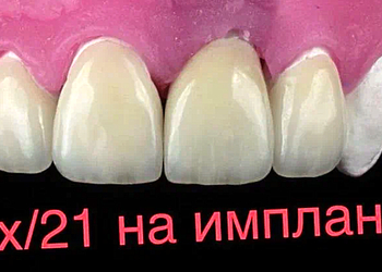 Фото клиники Клиника Эффективной Стоматологии — №22