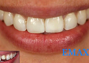 Фото клиники Клиника Эффективной Стоматологии — №23