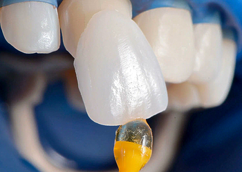 Фото клиники Цифровая стоматология на Хохрякова — №24