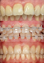 Фото клиники Цифровая стоматология на Хохрякова — №32