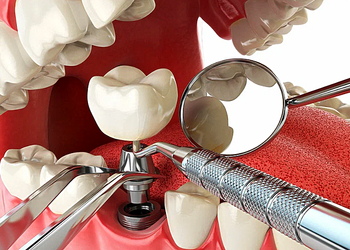 Фото клиники Цифровая стоматология на Начдива Васильева — №27