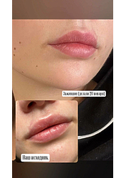 Фото клиники Центр здоровья и красоты Здоровая кожа — №29