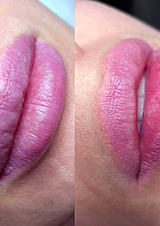 Фото клиники Центр здоровья и красоты Здоровая кожа — №32