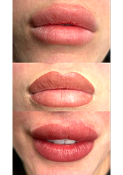 Фото клиники Центр здоровья и красоты Здоровая кожа — №33