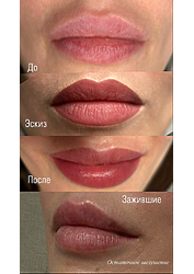 Фото клиники Центр здоровья и красоты Здоровая кожа — №34