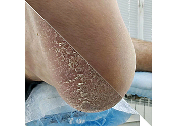 Фото клиники Центр здоровья и красоты Здоровая кожа — №38