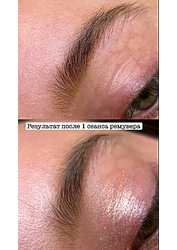 Фото клиники Центр здоровья и красоты Здоровая кожа — №42