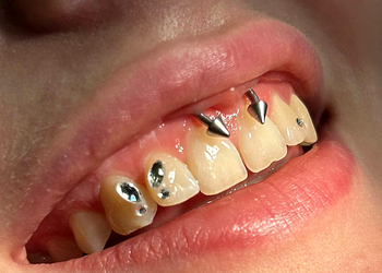 Фото клиники Стоматология Клевер на Глумилинской — №11