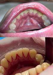 Фото клиники Стоматология Клевер на Глумилинской — №12