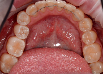 Фото клиники Стоматология Клевер на Глумилинской — №13