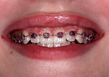 Фото клиники Новая улыбка — №18