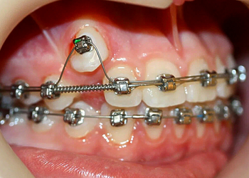 Фото клиники Стоматология Энже на Восстания — №12