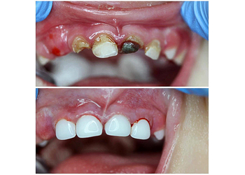 Фото клиники Стоматология Энже на Восстания — №9